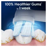 Oral-B Io Gentle Care Ανταλλακτικές Κεφαλές για Ηλεκτρική Οδοντόβουρτσα 8τμχ