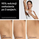 Braun Silk·expert Pro 5 Αποτριχωτική Μηχανή IPL για Πρόσωπο & Μπικίνι PL5210