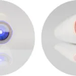 Medisana DC 300 Συσκευή Φωτοθεραπείας Προσώπου LED & Υπερύθρων κατά της Ακμής 85180